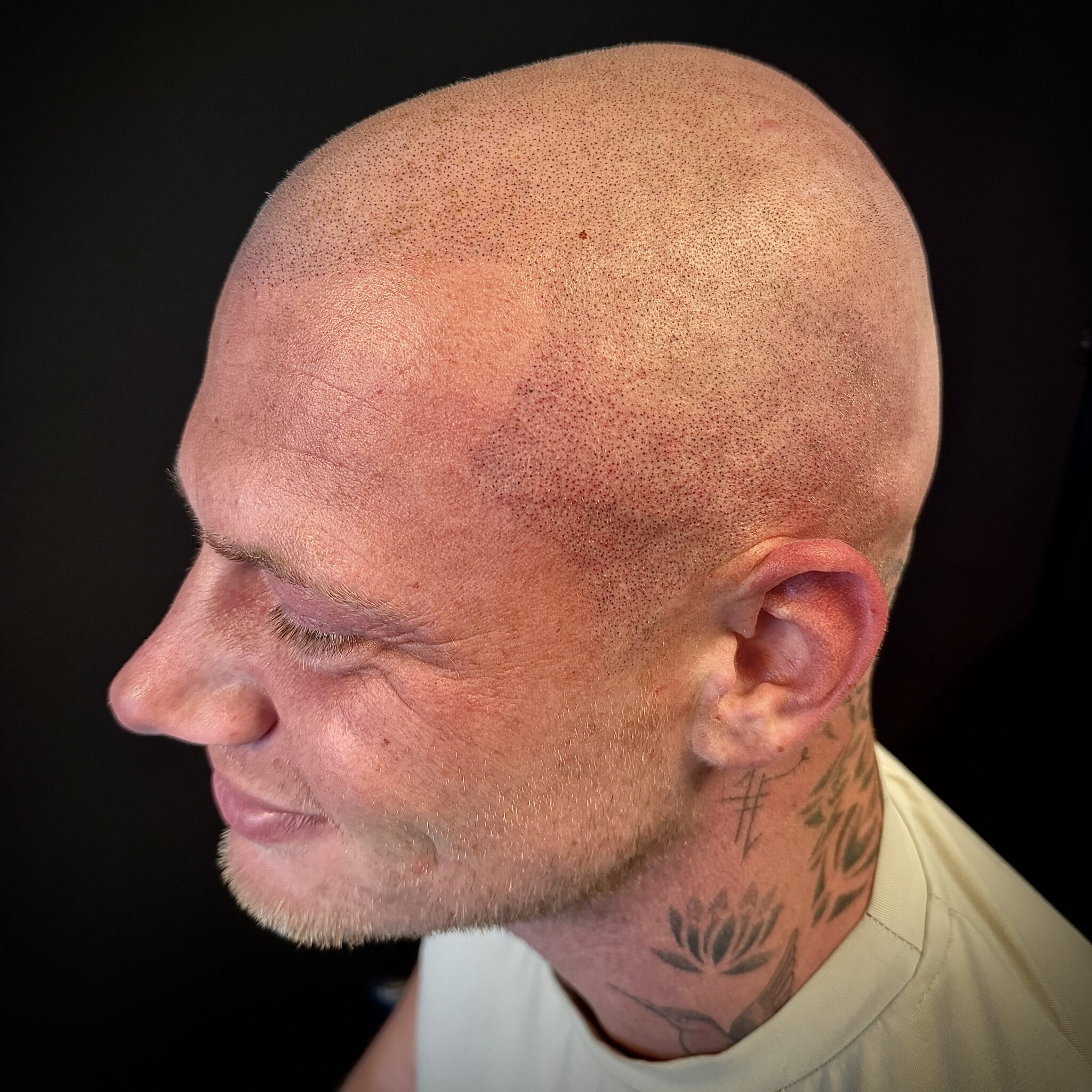 man met zwart achtergrond die lacht groen t-shirt en heeft een shaven look pigmentatie